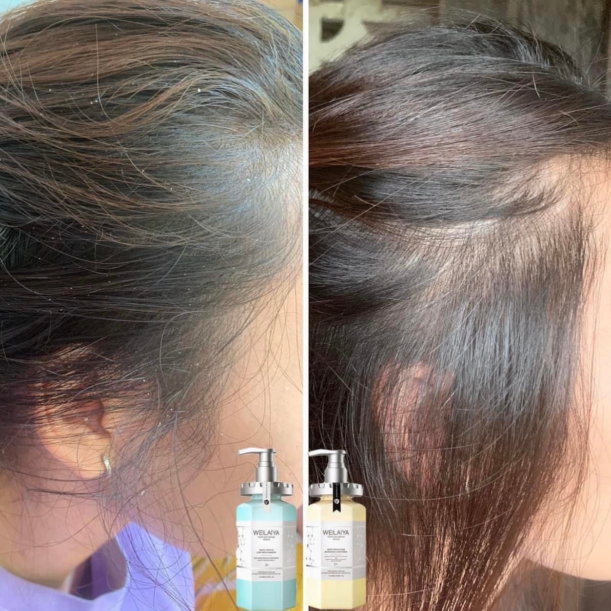 Bộ Gội Xả Phục Hồi Nấm Đa Tầng Truffle Weilaiya Perfume Repair Series