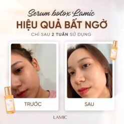 Combo Sữa rửa mặt TIA'M 200ml & Serum botox tươi LAMIC 35ml