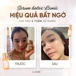 Combo Sữa rửa mặt TIA'M 200ml & Serum botox tươi LAMIC 35ml