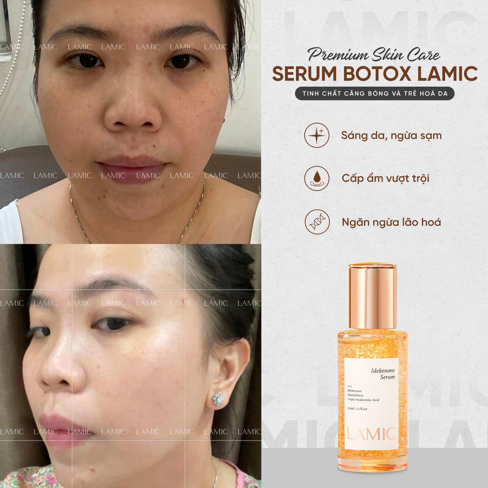 Serum cấp ẩm, hỗ trợ dưỡng trắng và phục hồi da botox tươi LAMIC 35ml