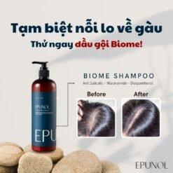 Dầu gội giảm gàu ngứa và ngăn tiết dầu trên da đầu Epunol Biome