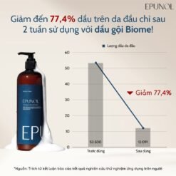 Dầu gội giảm gàu ngứa và ngăn tiết dầu trên da đầu Epunol Biome