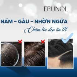 Dầu gội giảm gàu ngứa và ngăn tiết dầu trên da đầu Epunol Biome