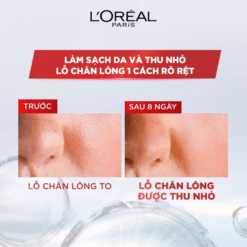 Nước Tẩy Trang Dành Cho Da Dầu Mụn L'ORÉAL Paris Revitalift Crystal Purifying Micellar Water For Oily Skin 400ml
