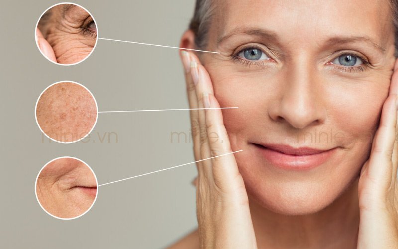 Biểu Hiện Của Lão Hóa Da Là Gì