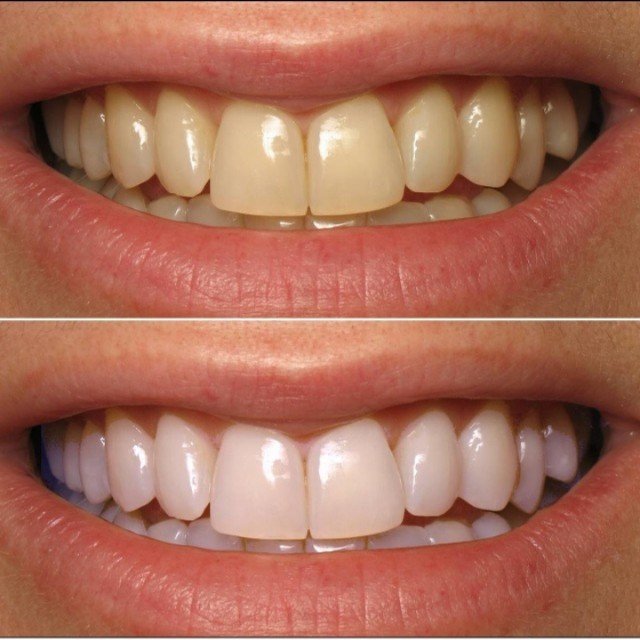 bot-lam-trang-rang-eucryl-huong-bac-ha-50g-4