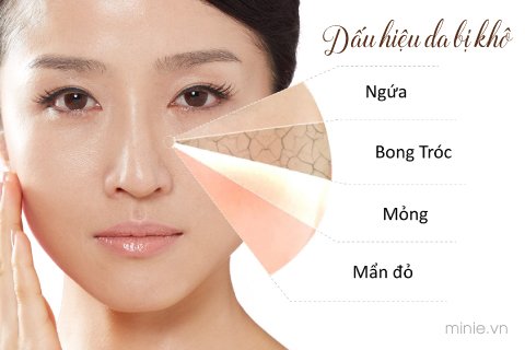 dau-hieu-da-mat-bi-kho Dấu hiệu da mặt bị khô