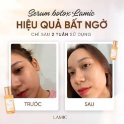 Serum cấp ẩm, hỗ trợ dưỡng trắng và phục hồi da botox tươi LAMIC 35ml
