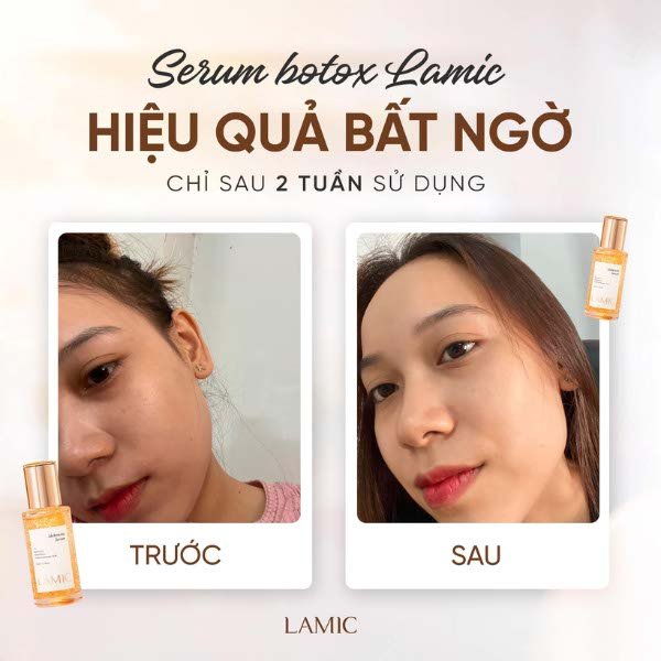 Serum cấp ẩm, hỗ trợ dưỡng trắng và phục hồi da botox tươi LAMIC 35ml