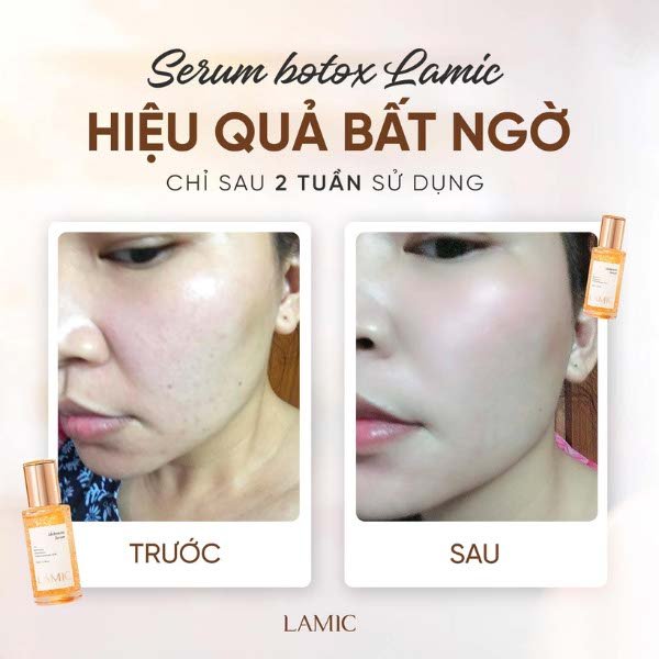 Serum cấp ẩm, hỗ trợ dưỡng trắng và phục hồi da botox tươi LAMIC 35ml