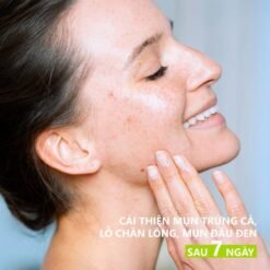 Nước hoa hồng làm dịu da, giảm kích ứng SVR Sebiaclear Micro Peel 150ml