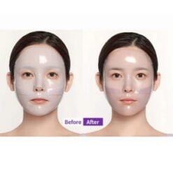 Mặt nạ thạch cung cấp collagen MediAnswer