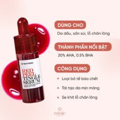 Serum So'Natural Tái Tạo Peel Da Sinh Học 11ml Red Peel Tingle Serum