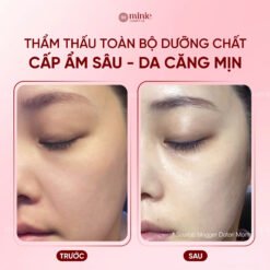 Mặt nạ dưỡng ẩm d'Alba White Truffle Nourishin Treatment Mask